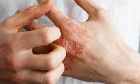 Câu chuyện về nỗi ám ảnh ‘nửa sống nửa chết’ vì loại thuốc hàng triệu người tin dùng