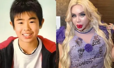 Dao kéo hơn 200 lần để thành 'người đẹp nhất thế giới'