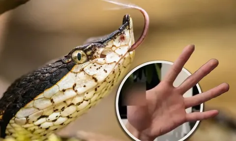 Nuôi rắn độc làm thú cưng, người đàn ông bị cắn mất ngón tay