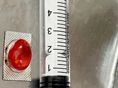 Người đàn ông nhập viện vì uống thuốc quên bóc vỏ