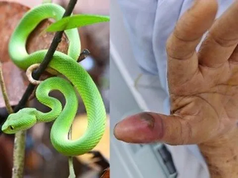 Rắn độc "nấp" trong nhà vệ sinh cắn người vừa ngủ dậy