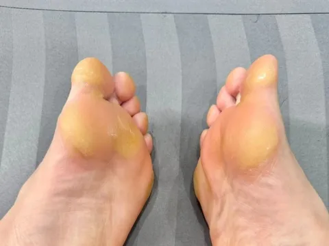 Đôi bàn chân gây chú ý của hot girl bóng đá Hoàng Thị Loan