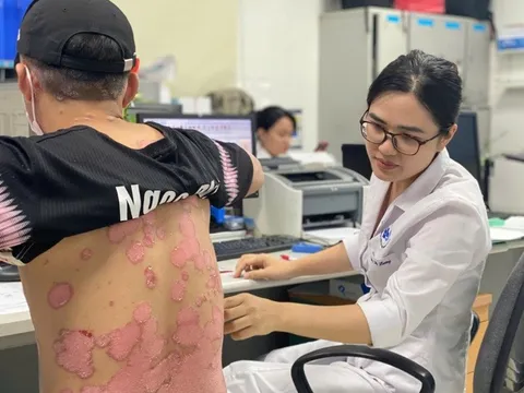 2 triệu người Việt mắc căn bệnh bong tróc da toàn thân