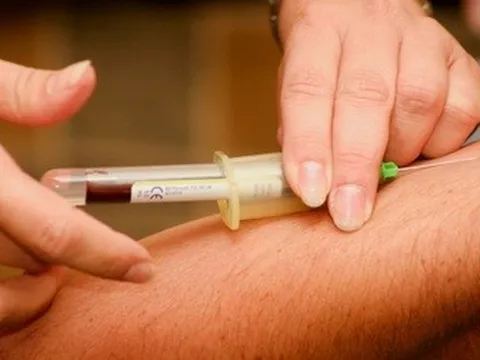 Những sai lầm khi xét nghiệm máu ít ai để ý