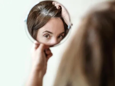 Sự thật tóc bạc cảnh báo nguy cơ ung thư da?