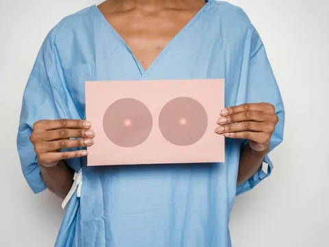 Những dấu hiệu cảnh báo ung thư vú sớm rất dễ bị bỏ qua