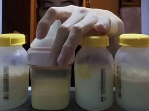 Tranh cãi việc lấy sữa sản phụ mới sinh pha cà phê uống: Bác sĩ lên tiếng