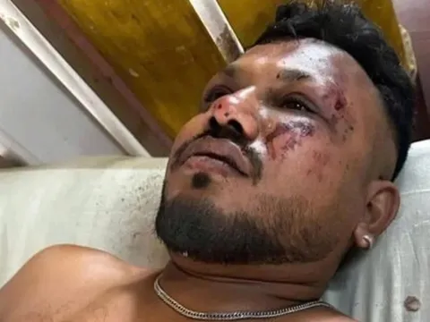 Người sống sót duy nhất trong vụ rơi máy bay Air India kêu cứu