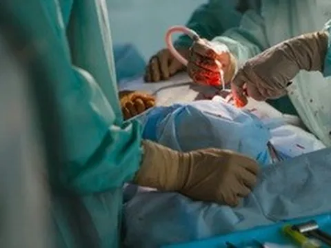 Cuộc mổ giải thoát người phụ nữ khỏi cơn đau nửa đầu xuyên 2 thập kỷ