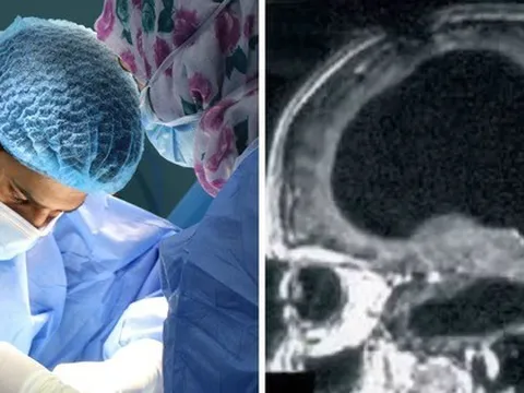 Bí ẩn về người đàn ông mất 90% não, nhưng vẫn có thể sống một cuộc sống bình thường