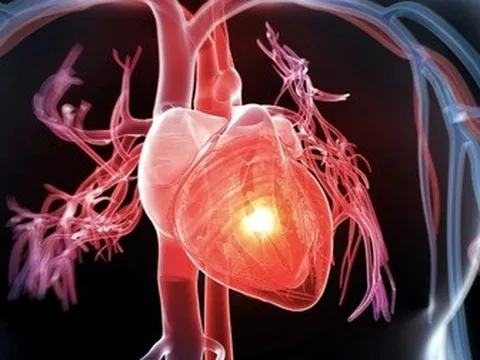 Căn bệnh hiểm ở tim, trẻ mắc phải dễ tử vong trước tuổi trưởng thành