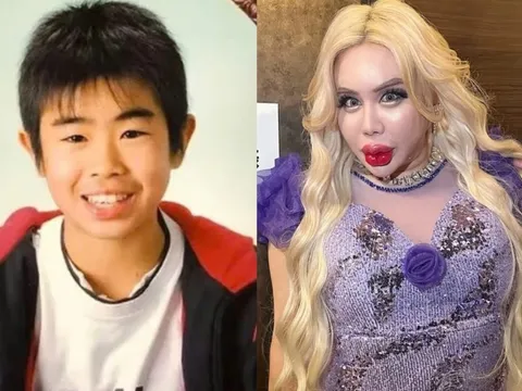 Dao kéo hơn 200 lần để thành 'người đẹp nhất thế giới'