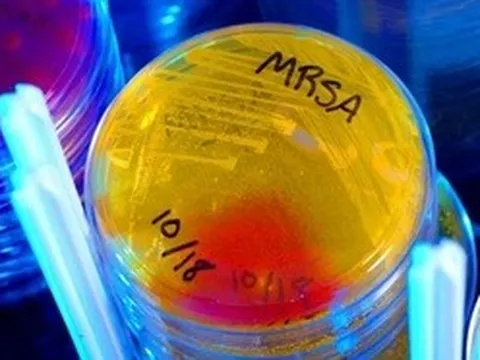 Phát hiện kháng sinh mạnh gấp 100 lần, mang hy vọng mới cho y học