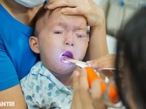 Trẻ mắc cúm A, bệnh hô hấp tăng nhanh, chuyên gia khuyến cáo