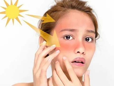 Thu hồi kem chống nắng kém chất lượng, chỉ số chống nắng "có như không"