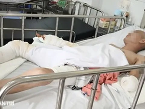 TPHCM: Cấp cứu nhiều ca ngưng tim, cắt cụt tay vì bị điện giật trên mái nhà