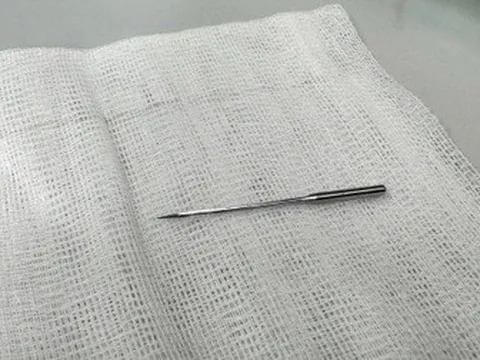 Gắp kim may 4cm trong bụng bé 11 tuổi