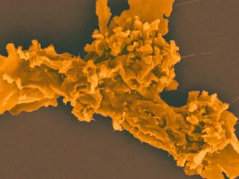 Phát hiện sinh vật mới sinh sôi ở nhiệt độ 63°C