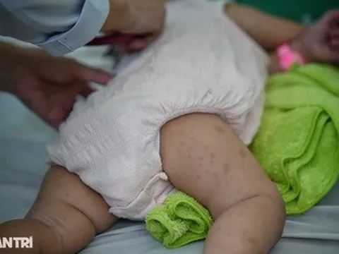 Sở Y tế TPHCM cảnh báo tác nhân gây bệnh truyền nhiễm quay trở lại