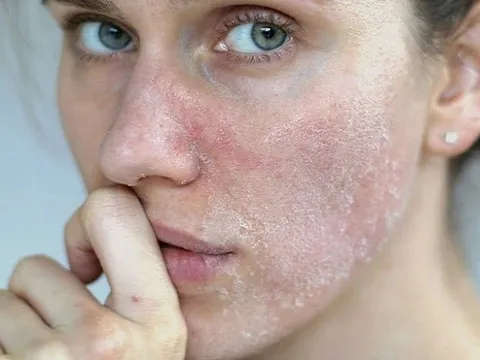 Thận yếu da có thể xuất hiện 6 triệu chứng lạ mà quen này