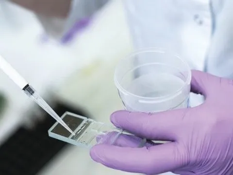 Châu Âu chấn động vụ gần 200 trẻ sinh ra từ tinh trùng người mang gene gây ung thư