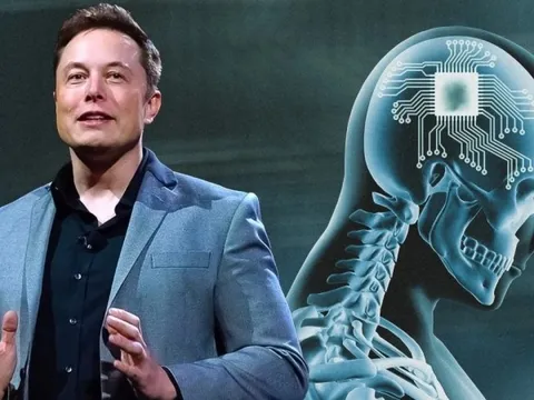 Công ty của Elon Musk chỉ mất 1,5 giây để cấy chip vào não người