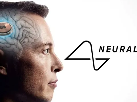 Công ty của Elon Musk cấy chip vào não người chỉ trong 1,5 giây, độ chính xác cực cao giúp tránh các mạch máu nhỏ