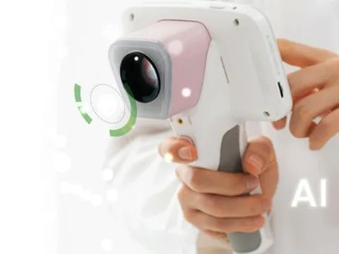 Loại ung thư làm 2.500 phụ nữ Việt tử vong/năm: AI tầm soát được không?