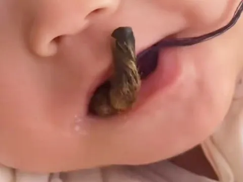 Xôn xao việc cho trẻ ngậm “tay khỉ khô đầy lông” để... ngừa bệnh cam