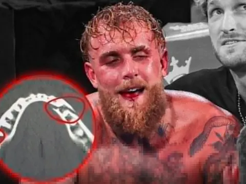 Jake Paul gãy xương hàm, bị cấm thượng đài