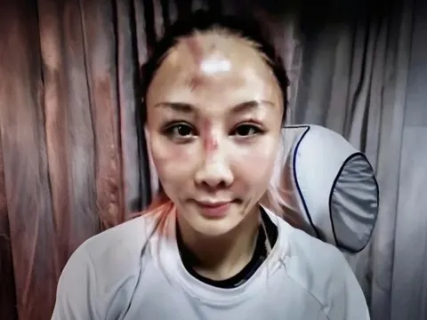 Nữ giám đốc Trung Quốc bỏ việc, đi thi tát đến biến dạng mặt