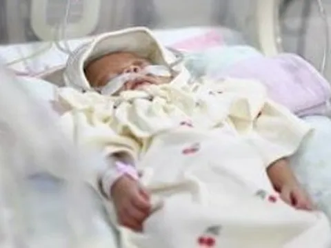 Bé gái Hàn Quốc sinh non chỉ nặng 328 gram, 6 tháng sau nặng 4kg