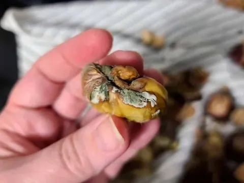 Trung Quốc: Cô gái 27 tuổi bị ung thư dạ dày vì 3 món hay trữ trong tủ lạnh