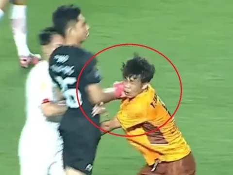 Cầu thủ HAGL bị đấm vào mặt