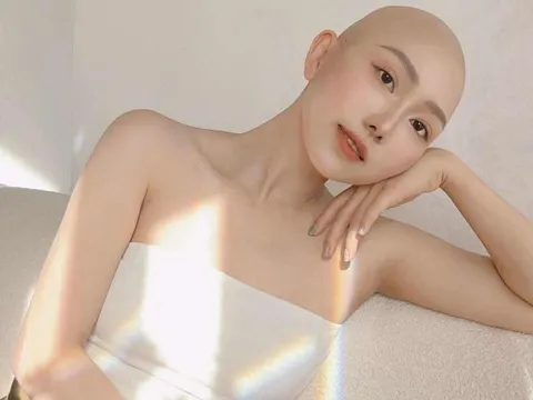 Bức ảnh của cô gái TP.HCM mắc ung thư ở tuổi 28 viral khắp MXH