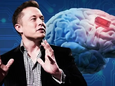 Chip não của Elon Musk sắp sản xuất hàng loạt