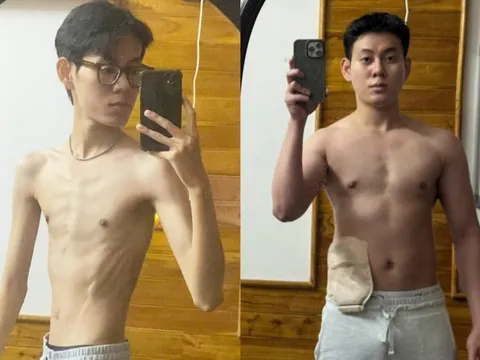 'Da bọc xương' vì ốm nặng, chàng trai lột xác khi tăng 30 kg sau 1 năm