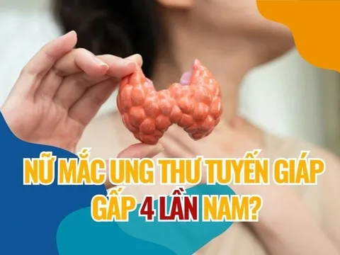 Giải mã lý do nữ giới mắc ung thư tuyến giáp cao gấp 4 lần nam giới