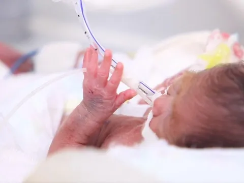 Bé sơ sinh nặng chưa tới nửa ký được cứu sống ngoạn mục