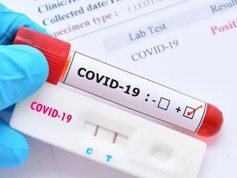 Giá xét nghiệm Covid-19 đang được quản lý như thế nào?
