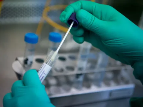 Bộ Y tế đề nghị thanh tra việc nhập khẩu, mua sắm test kit Covid-19